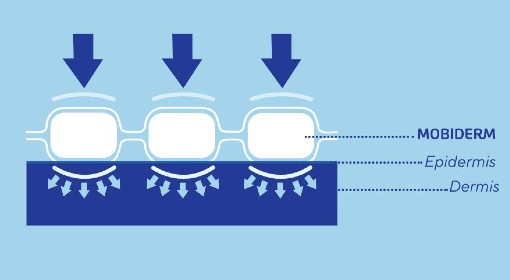 Mobiderm Principle